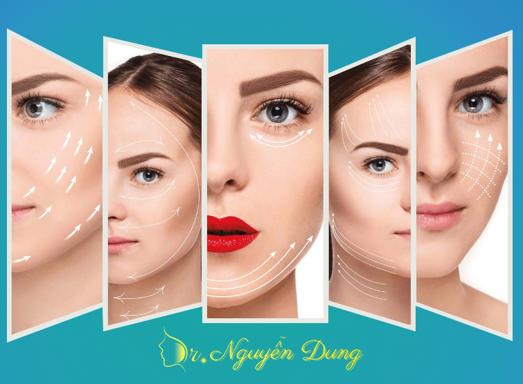 căng da mặt bằng chỉ collagen sinh học tại dr nguyễn dung