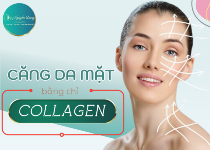 căng da mặt bằng chỉ collagen tại bác sĩ nguyễn dung