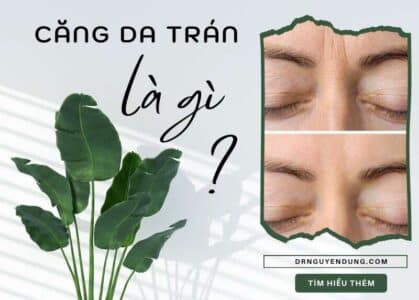 căng da trán là gì