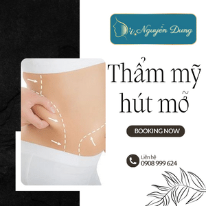 Thẩm mỹ hút mỡ